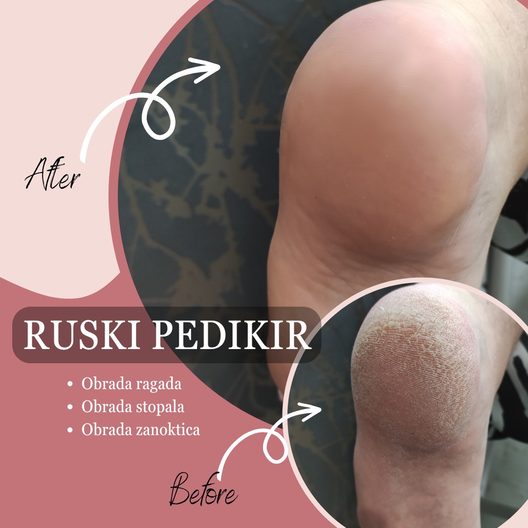 Link to Beauty #beograd Gel lak Ruski pedikir - sređivanje peta/stopala/zanoktica