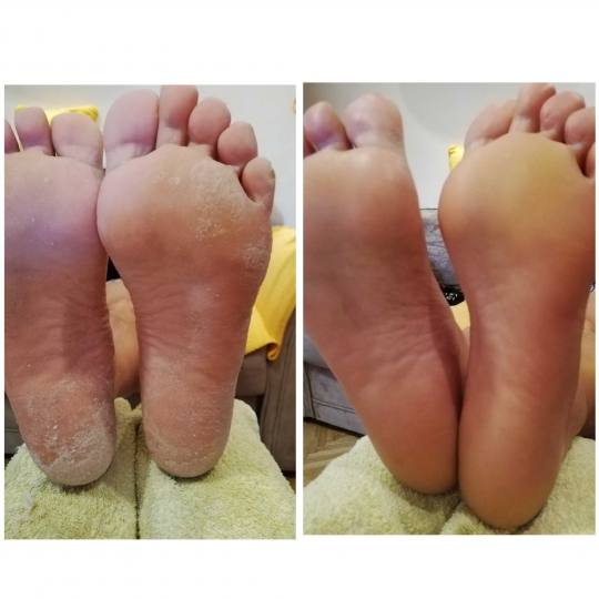 Vanila M #novisad medicinski pedikir
