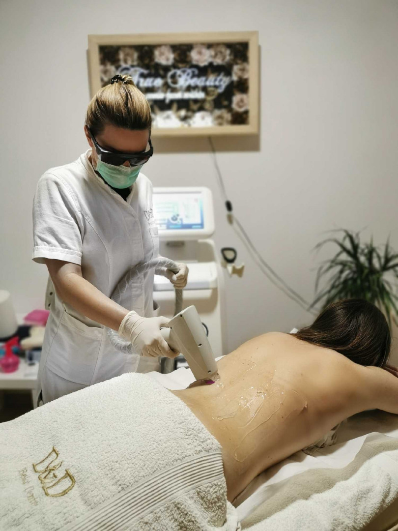 D&D Beauty Center #beograd Laserska epilacija Laserska epilacija donjeg dela leđa - za dame