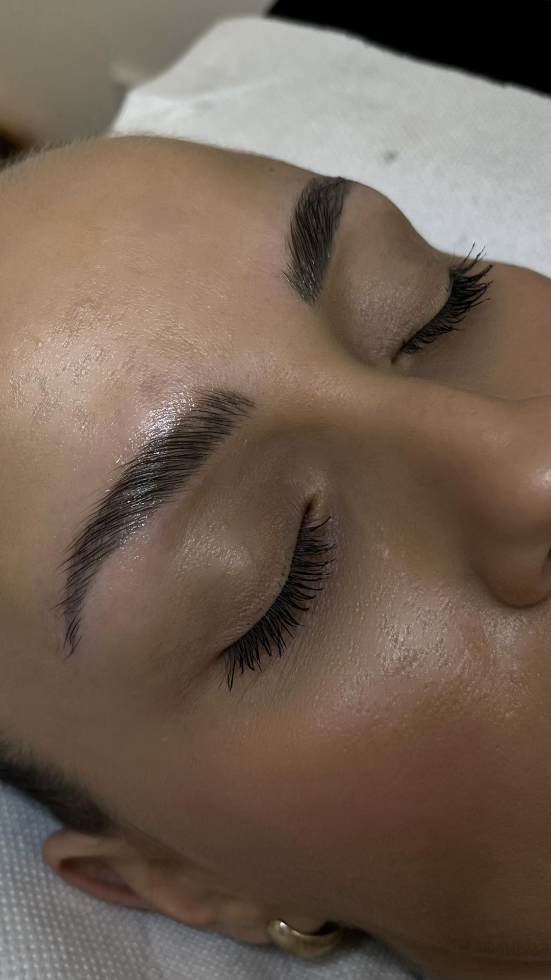 Brow lift - Artist Alex Studio, Niš Obrve Lice Obrve, Niš, Medijana