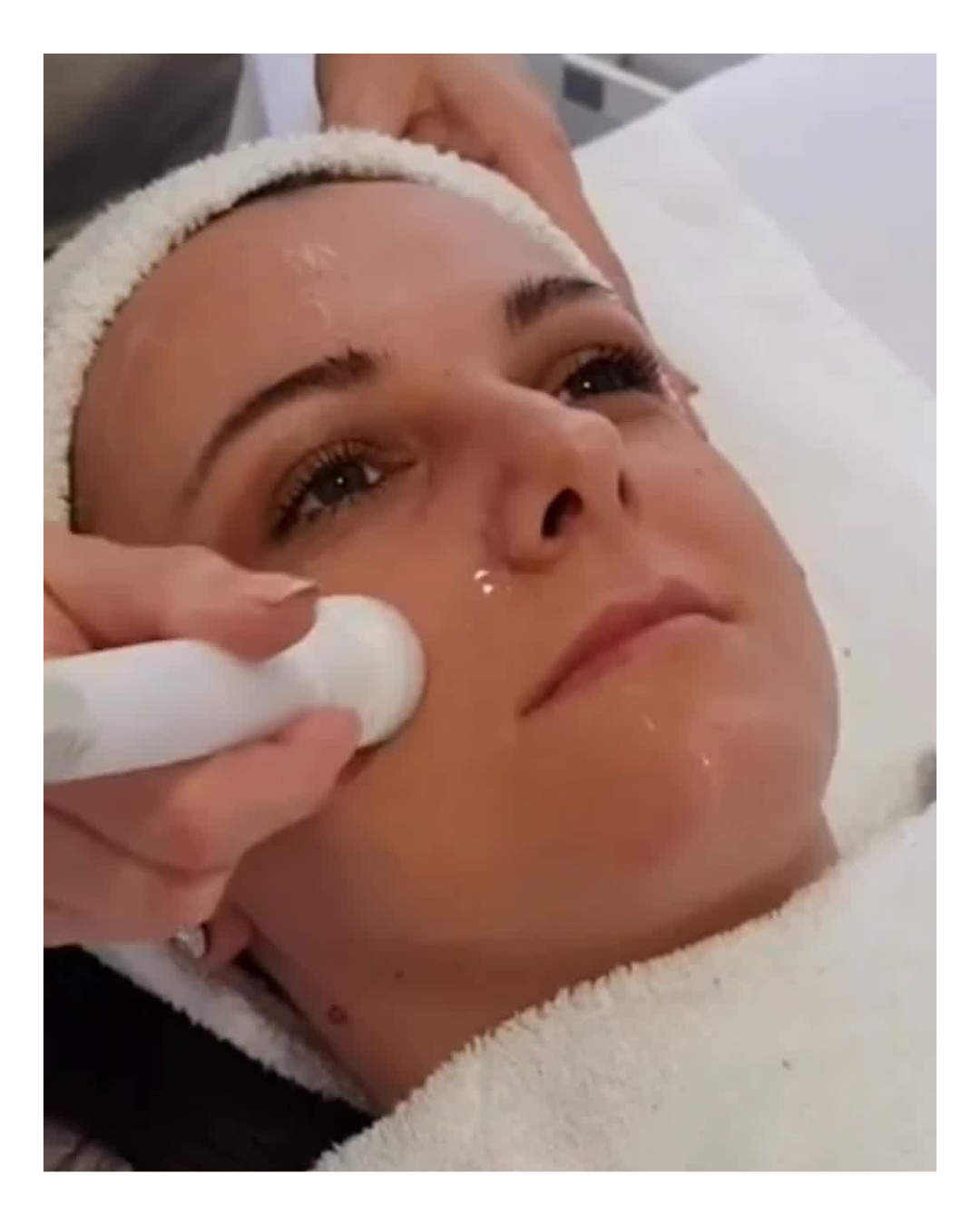 RUŠKA beauty studio #novisad Tretman lica Mezoporacija + serum + masaža lica