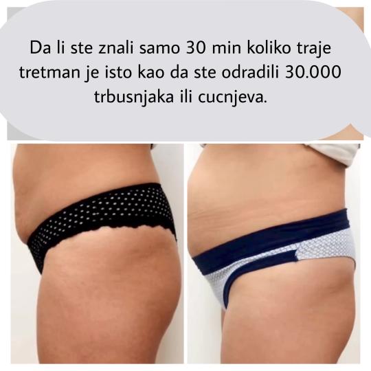 Belle Ana #beograd Tretmani tela EMS tretman - 2 regije