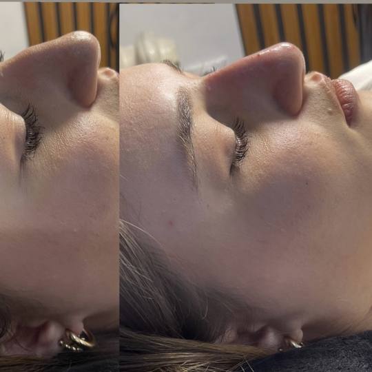 Estetik beauty centar usluga