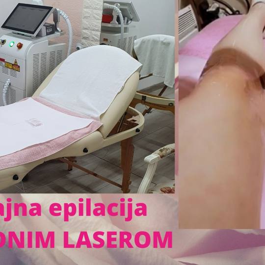 My little secret #beograd Laserska epilacija Laserska epilacija celih nogu