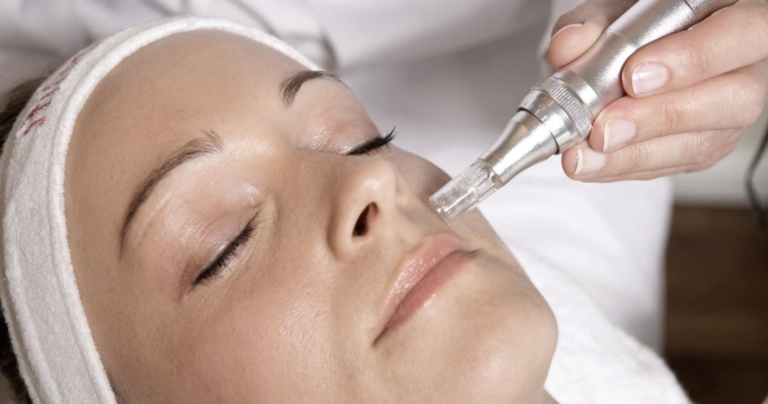 Salon Klinik #beograd Dermaroler i dermapen Dermapen