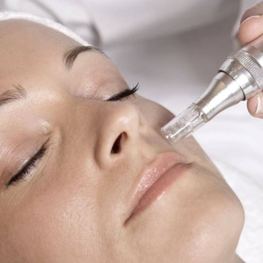 Salon Klinik #beograd Dermaroler i dermapen Dermapen