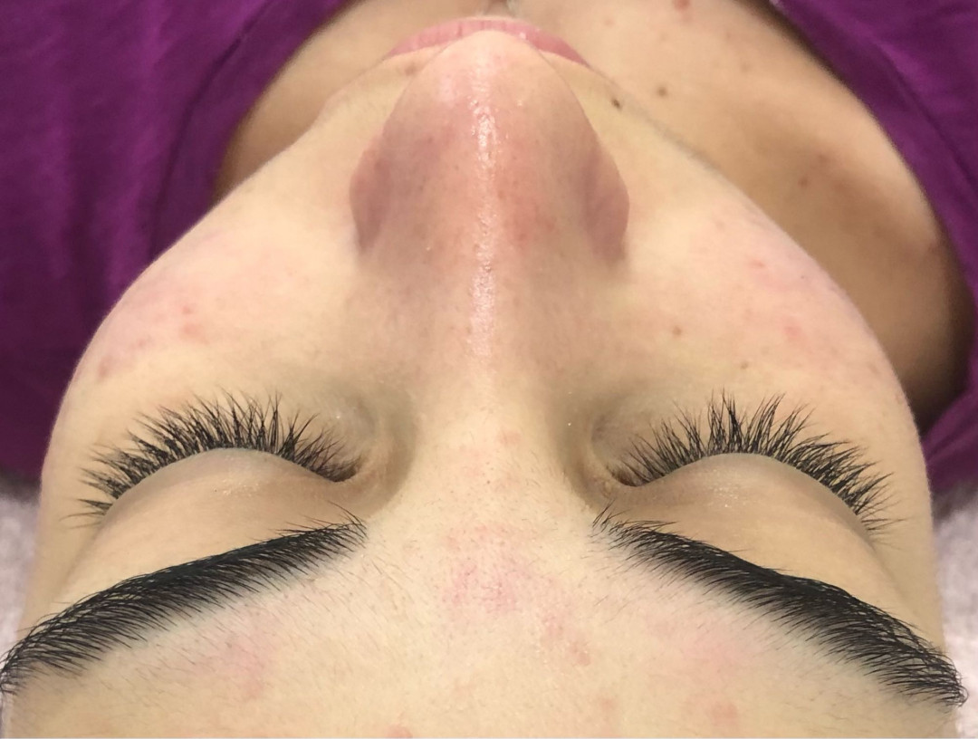 Čišćenje lica ultrazvučnom špatulom + hidratacija - Makeup Olja Grbić, Novi Sad Tretman lica Lice Tretman lica, Novi Sad, Rotkvarija, Podbara, Salajka
