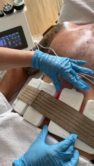 Lipolaser Centar - Matrix021 #novisad Tretmani tela