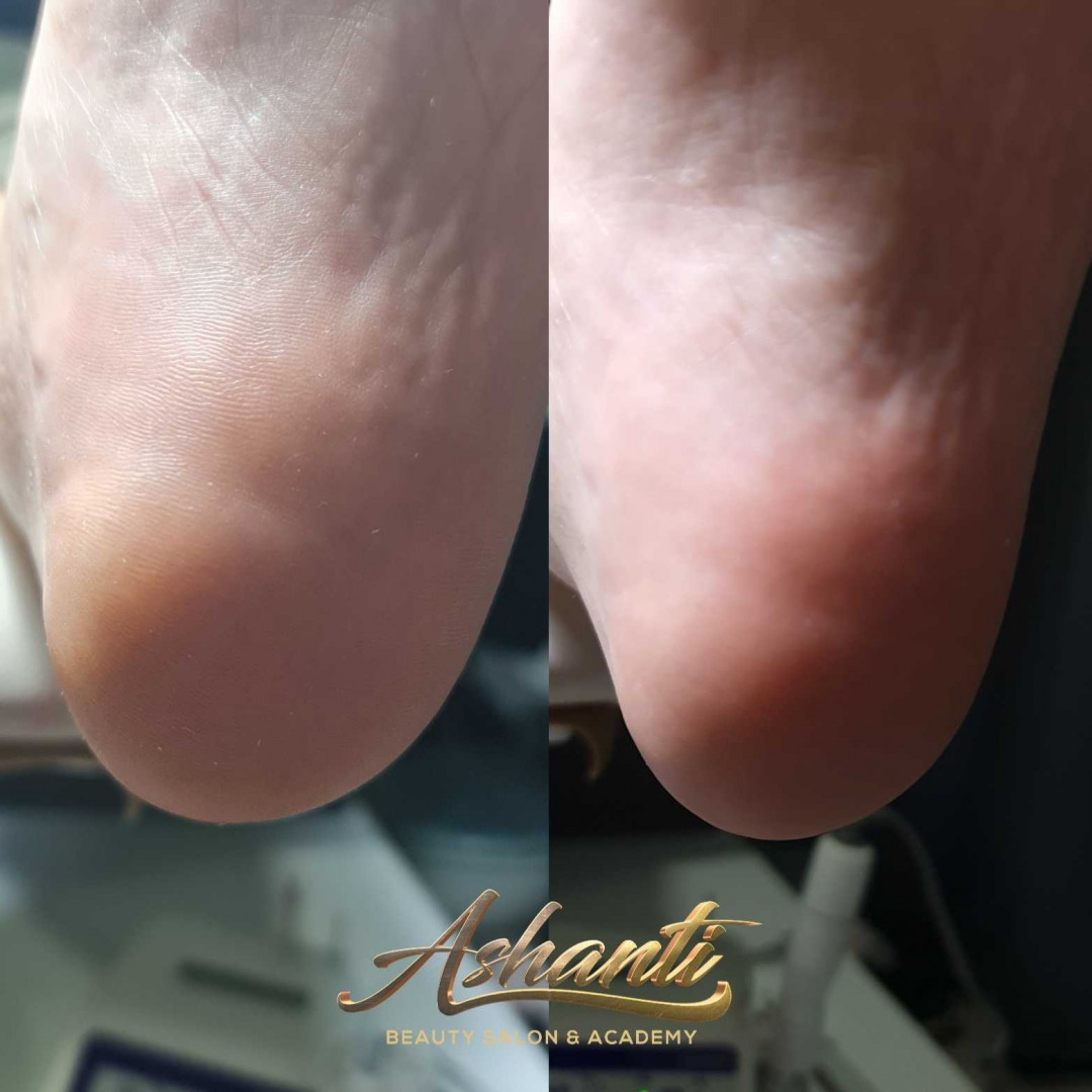 Ruski pedikir + lakiranje noktiju - Ashanti Beauty Salon & Academy, Beograd Estetski pedikir Nokti Estetski pedikir, Beograd, Voždovac