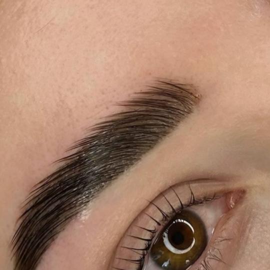 Esthetique Privé #beograd Obrve Brow lift + botox (nega)
