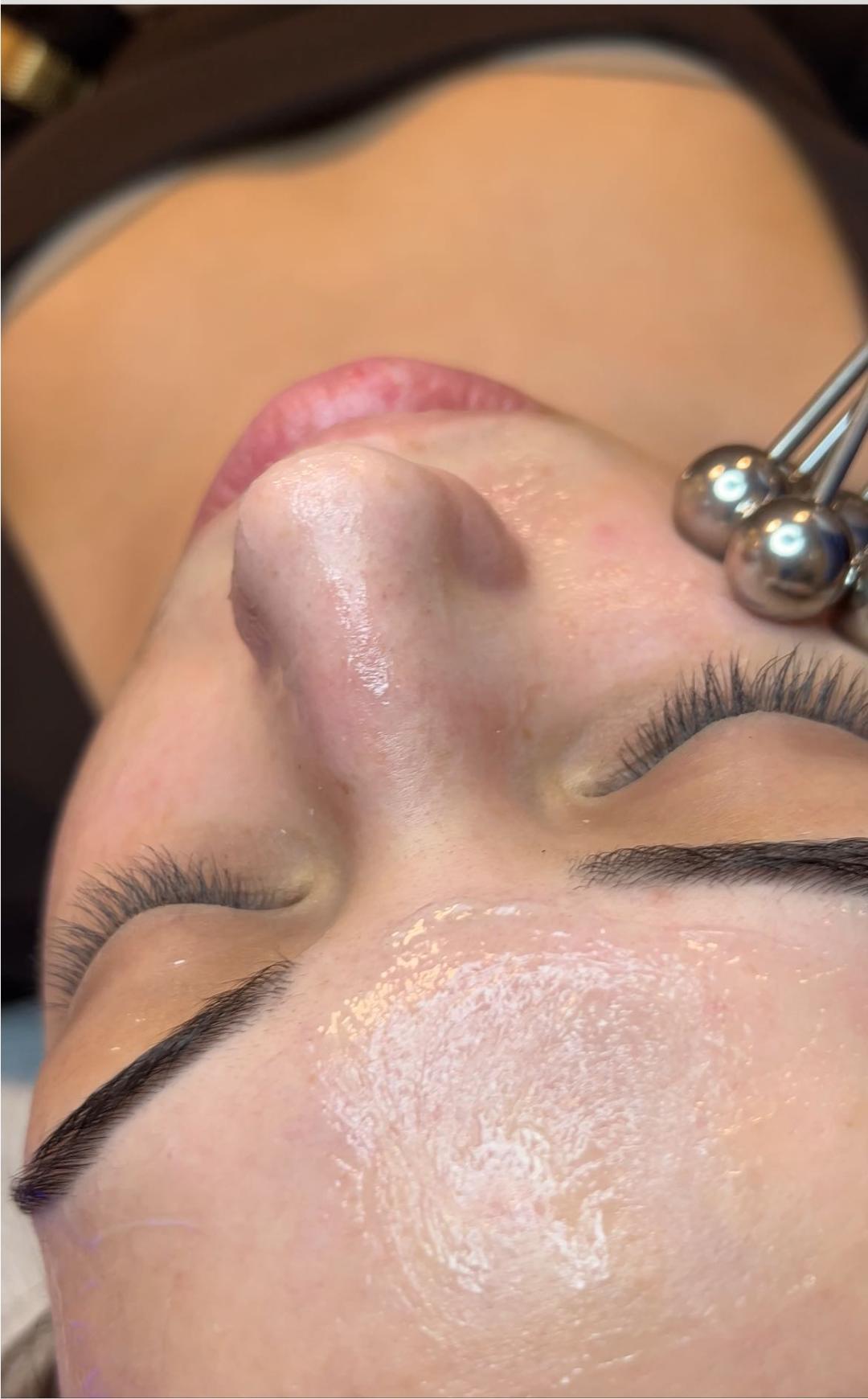 Hydrafacial - tretman lica + Dermapen ( anti aging, ožiljci, pigmentacija) - Esthetique Privé, Beograd Tretman lica Lice Tretman lica, Beograd, Centar, Stari grad, Dorćol