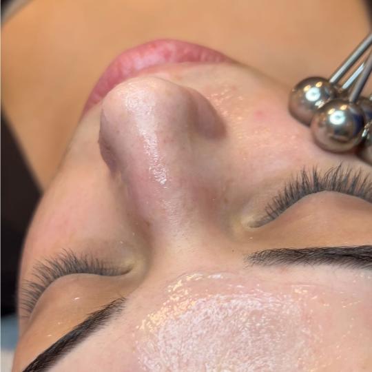 Esthetique Privé #beograd Tretman lica Hydrafacial - tretman lica + Dermapen ( anti aging, ožiljci