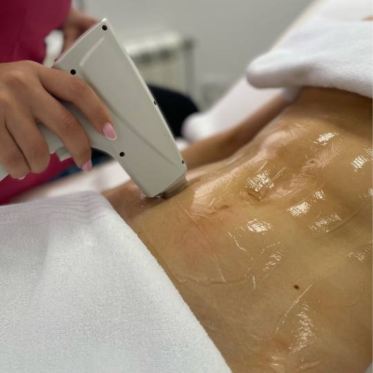 GM Beauty studio #beograd Laserska epilacija Laserska epilacija celog stomaka - za dame