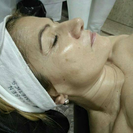 Iris + #beograd Tretmani protiv bora Vitafore vitamin C bio mask anti - age tretman Anti - age tretm