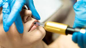 Vila Beauty Studio #beograd Tretman lica Hijaluron tretman lica