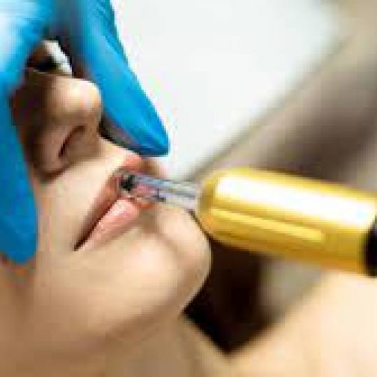 Vila Beauty Studio #beograd Tretman lica Hijaluron tretman lica Hijaluron pen je razvijen u Južnoj 