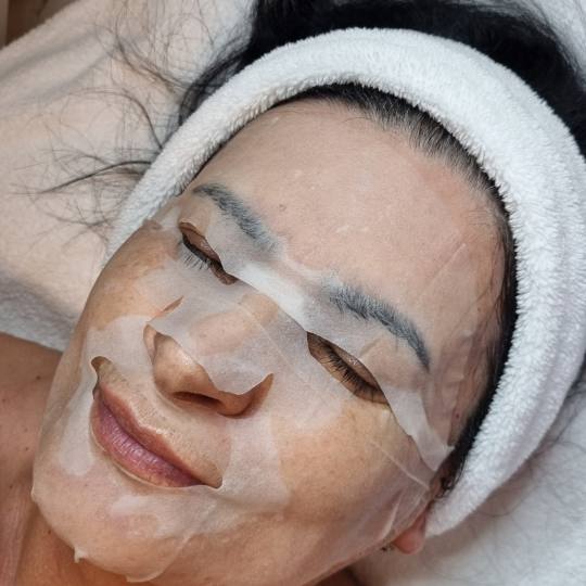 Emilly #beograd Tretman lica Mezoporacija lica Tretman je idealno rešenje za duboku hidrataciju ko