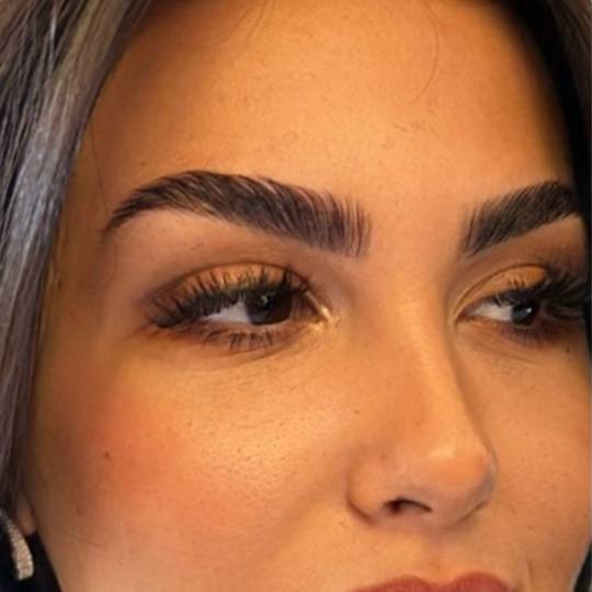Esthetique Privé #beograd Obrve Brow lift +farbanje obrva+ botox