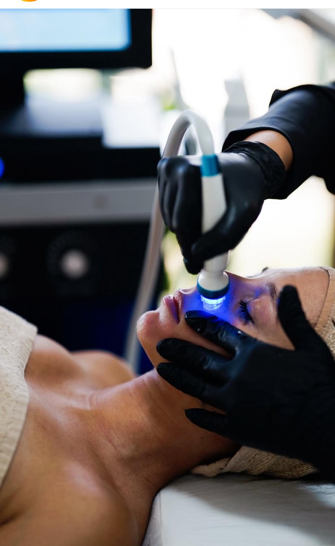 Beauty and nutrition #beograd Kozmetički doktori Mikrodermoabrazija+bubble pen+mezoporacija