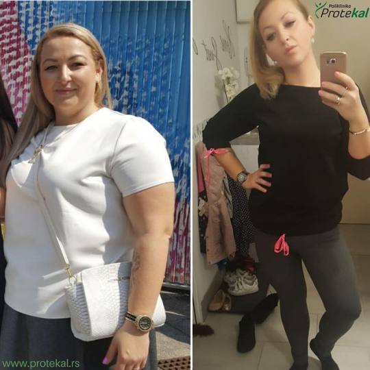 Poliklinika Protekal #beograd Nutricionista Program protekal ishrane - kontrola