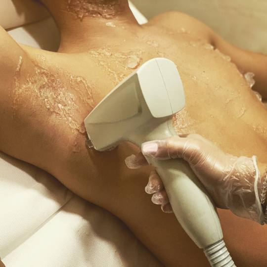 Ad Astra Spa & Epil House #beograd Laserska epilacija