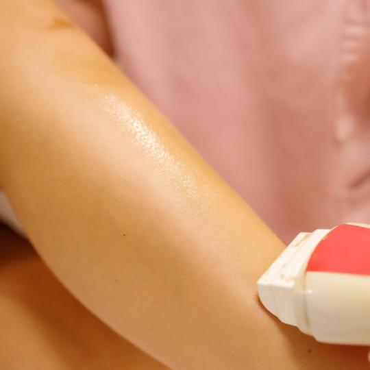 In line 1 #pancevo Depilacija nogu Depilacija celih nogu hladnim voskom - za dame