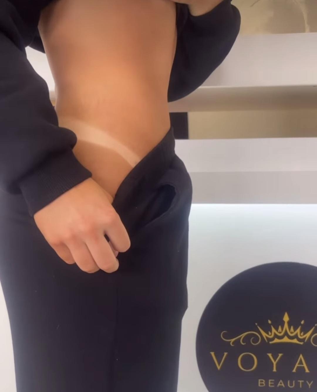 Voyage beauty #beograd Air brush potamnjivanje kože Spray tan - celo telo