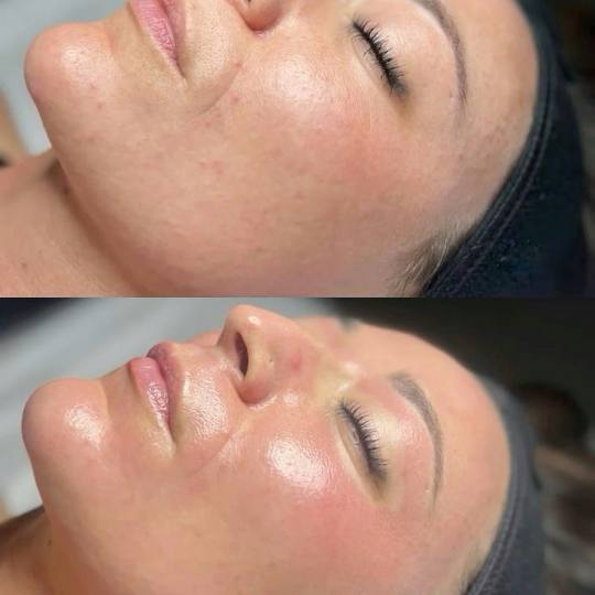 Xenija Beauty Room #beograd Tretman lica Dermapen tretman lica ✨ DERMA PEN TRETMAN ✨

Inovativ