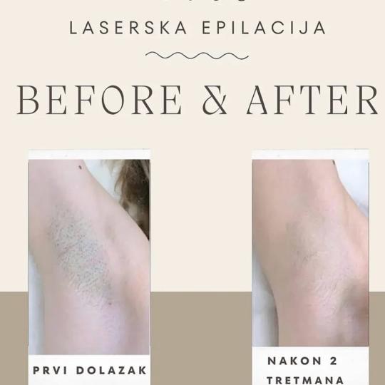 Vanilla rain beauty - Banovo brdo usluga