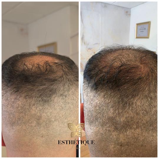 Esthetique Privé usluga