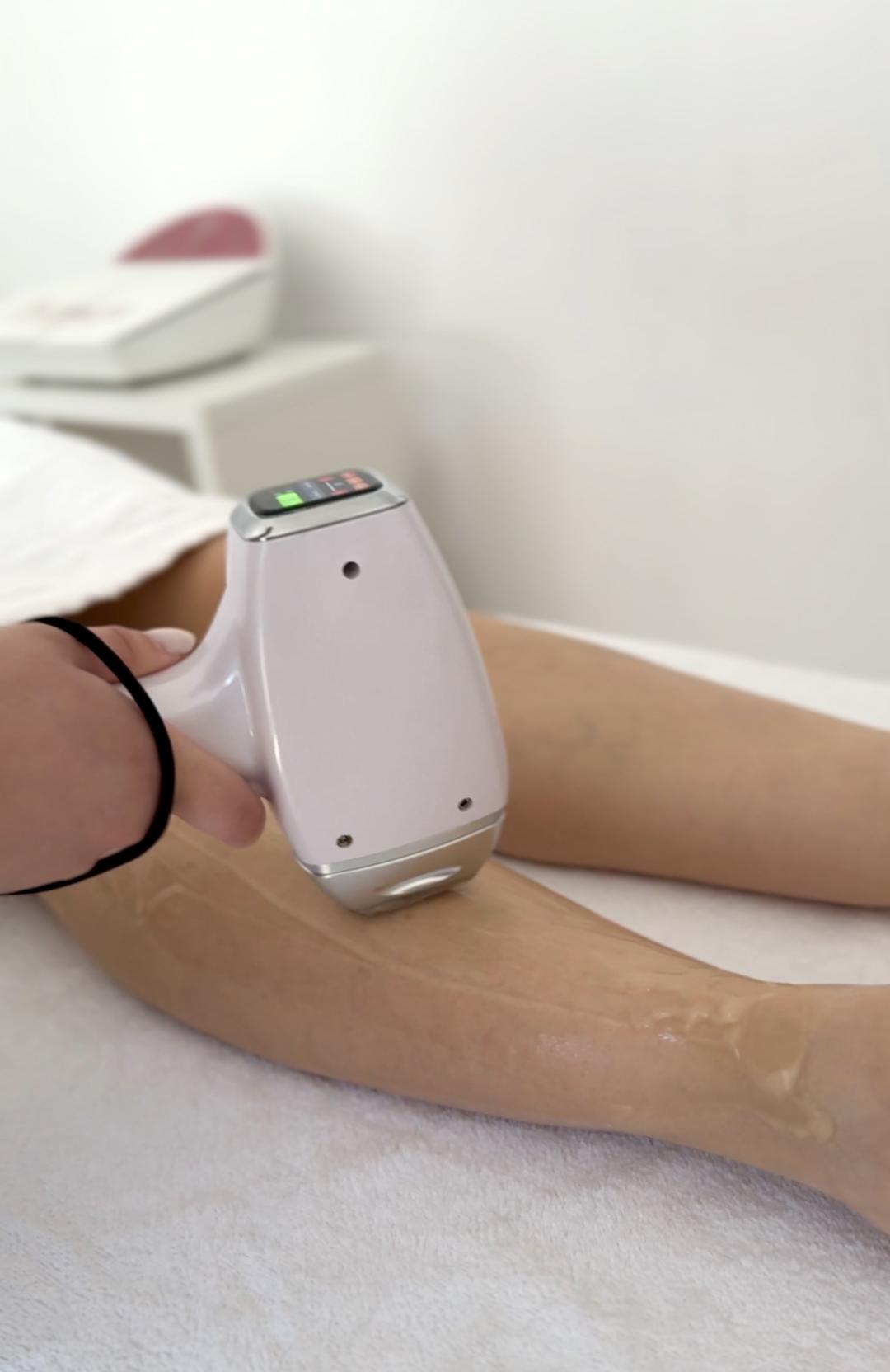 Lola esthetic center #beograd Laserska epilacija Laserska epilacija celih nogu - za dame