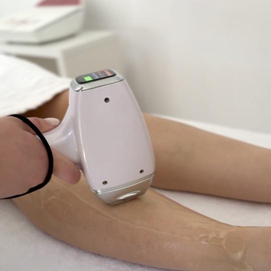 Lola esthetic center #beograd Laserska epilacija Laserska epilacija celih nogu - za dame