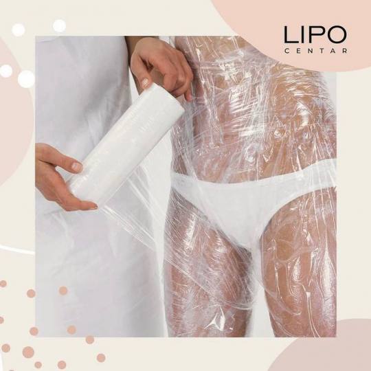 Lipo Centar #beograd Anticelulit