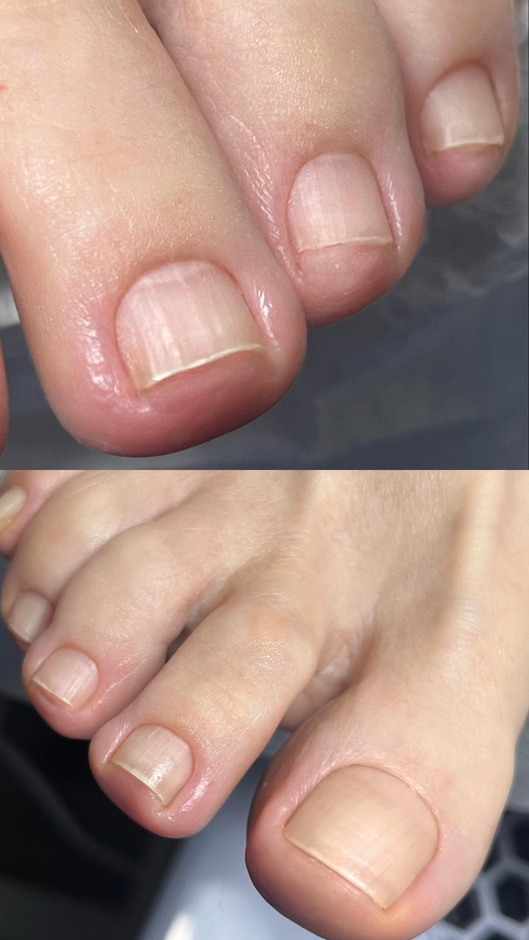 Estetski pedikir - majstor+ - Touch Aesthetic&Medical care, Beograd Estetski pedikir Nokti Estetski pedikir, Beograd, Vračar, Čubura, Crveni krst