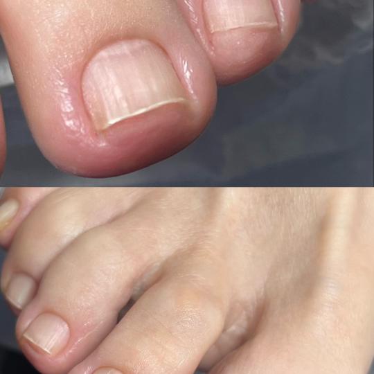 Touch Aesthetic&Medical care #beograd Estetski pedikir Estetski pedikir - majstor+ Rad majstora Ekat