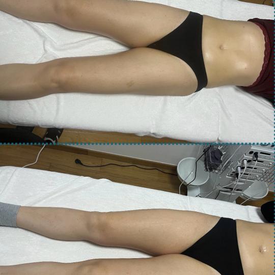 Diamond beauty #beograd Anticelulit masaža Kavitacija 30min+masaza lipomodelovanje jedne regije Rad