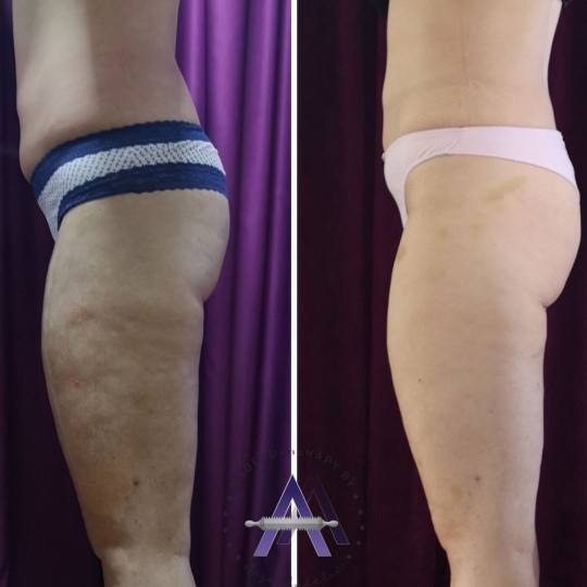 Estetic studio by Anja 2 #beograd