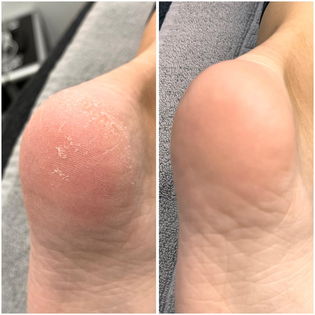 Belle Ana #beograd Estetski pedikir Ruski pedikir