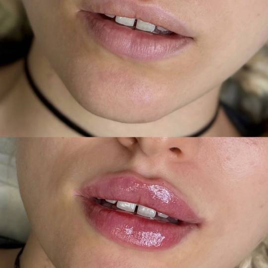 Estetik beauty centar usluga