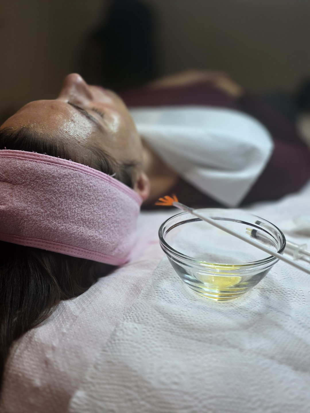 Starmedic #beograd Dermaroler i dermapen Holivudski sjaj - Jessner