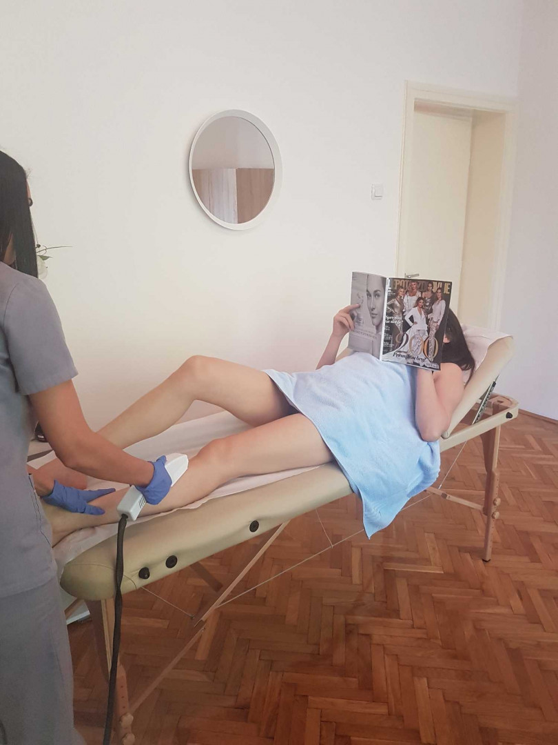 Unna Centar #beograd Epilacija IPL aparatom