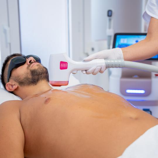 Monika Barta Cosmetics - Subotica #subotica Laserska epilacija Laserska epilacija grudi - za muškar