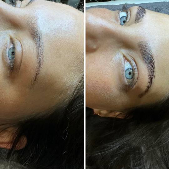 Baroque #beograd Obrve Brow lift