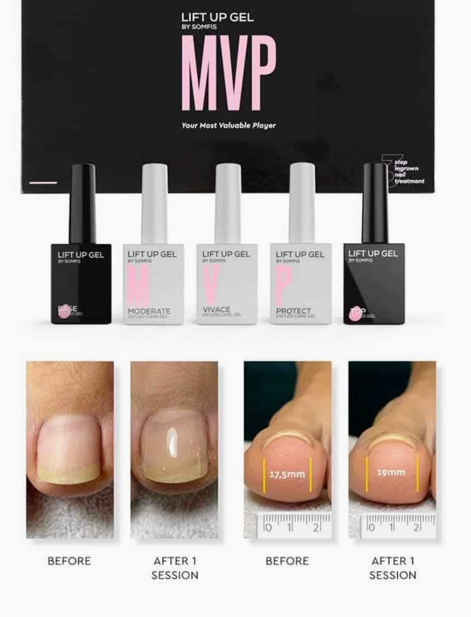 Lift up gel - palac - Kneginja, Beograd Izlivanje noktiju Nokti Izlivanje noktiju, Beograd, Slavija, Autokomanda, Neimar