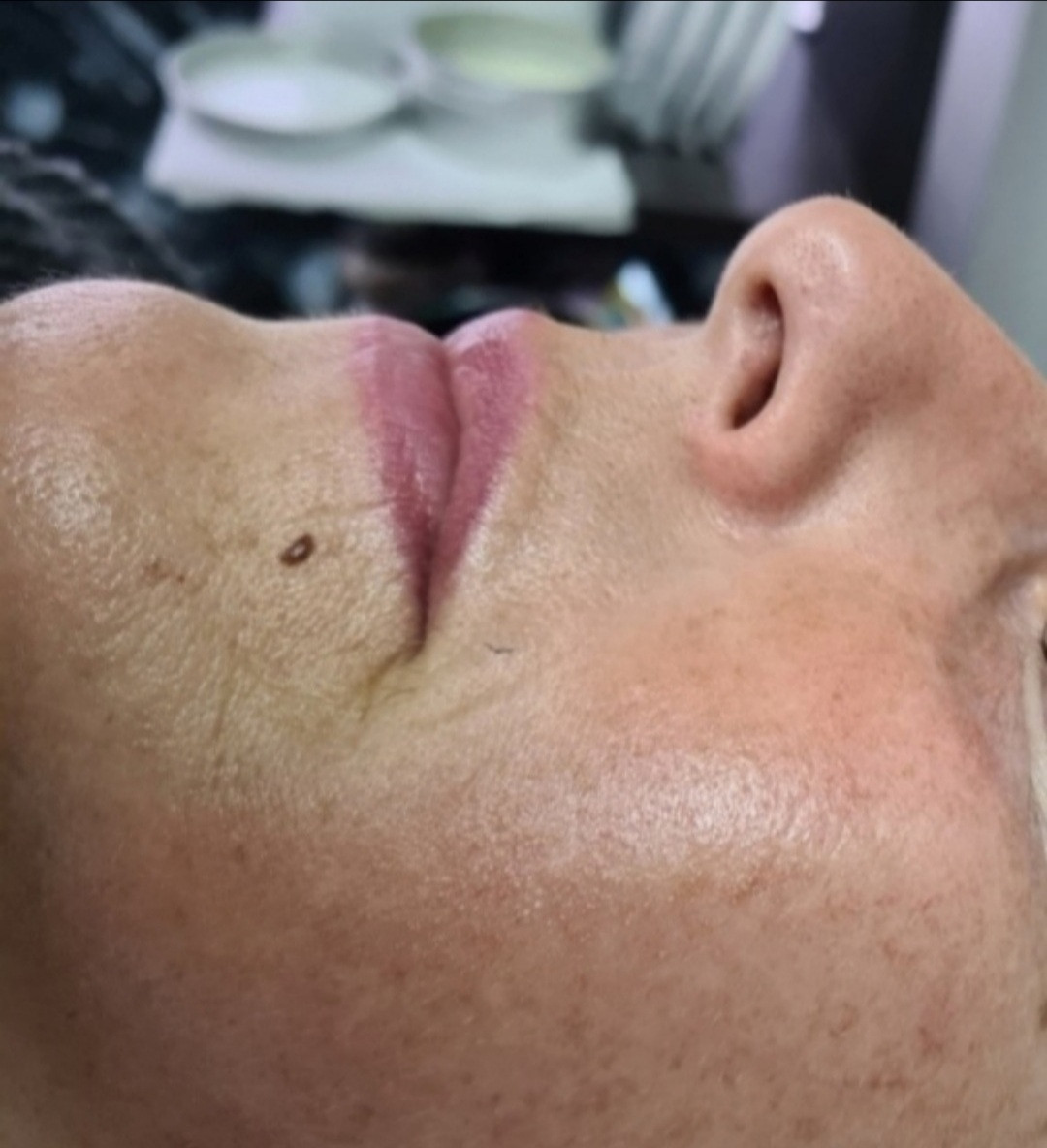 SunBox #beograd Masaža lica Face gym / Face fitness - anti age masaža lica