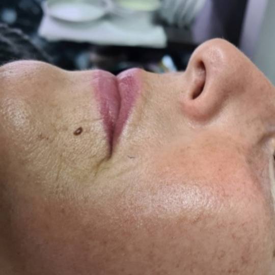 SunBox #beograd Masaža lica Face gym / Face fitness - anti age masaža lica