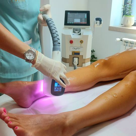 Laser centar Twins #beograd Laserska epilacija Laserska epilacija celih nogu - za dame