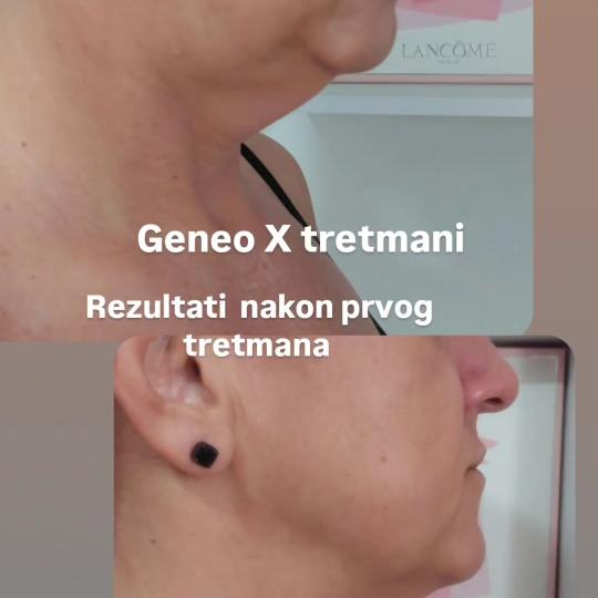 Anita M usluga