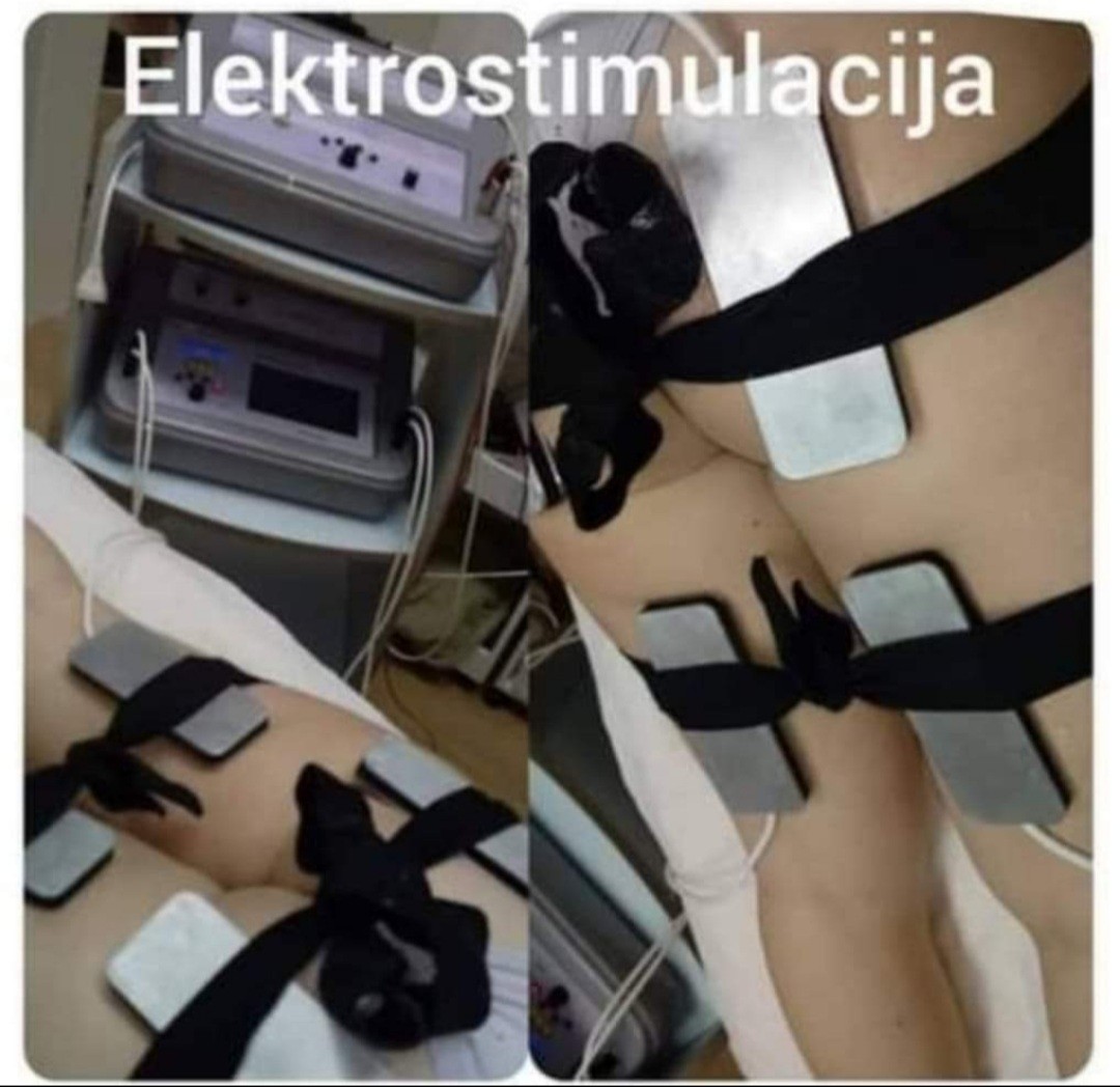 Studio Venera J #beograd Tretmani tela Elektrostimulacija mišića - paket od 5 tretmana