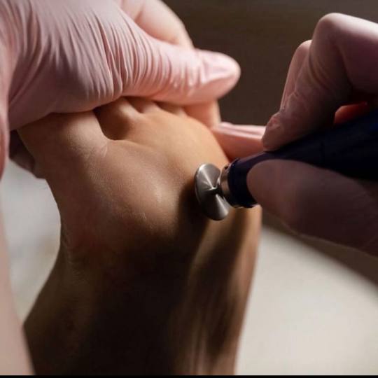 Milica Pavlović Beauty House #beograd Medicinski pedikir Medicinski aparatni pedikir - za dame(bez 